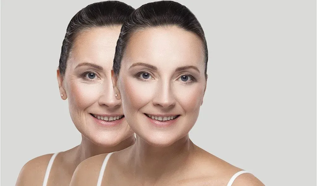 Chin improvement results from chin reduction plastic surgery, Oak Brook