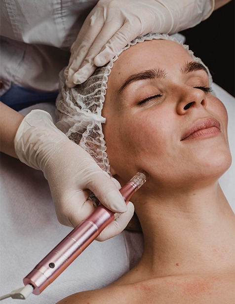 cheek laser session, sun-damage care, sciton resurfacing chicago