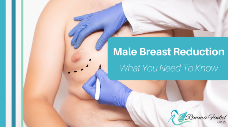 marking-session, male breast reduction consultation