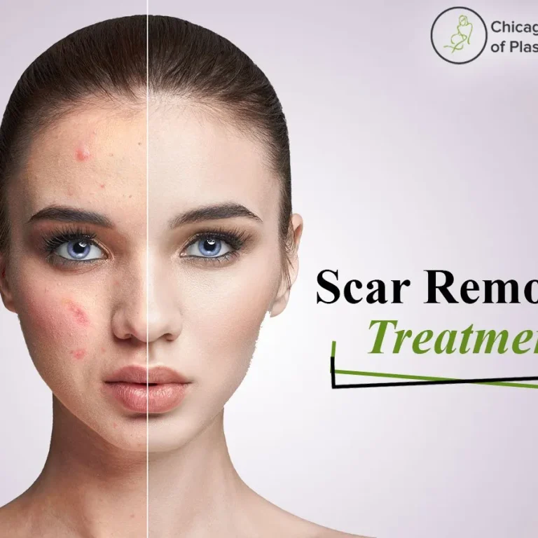 Best+Treatments+for+The+Removal+of+Scar+and+Make+Your+Skin+Smooth-1920w