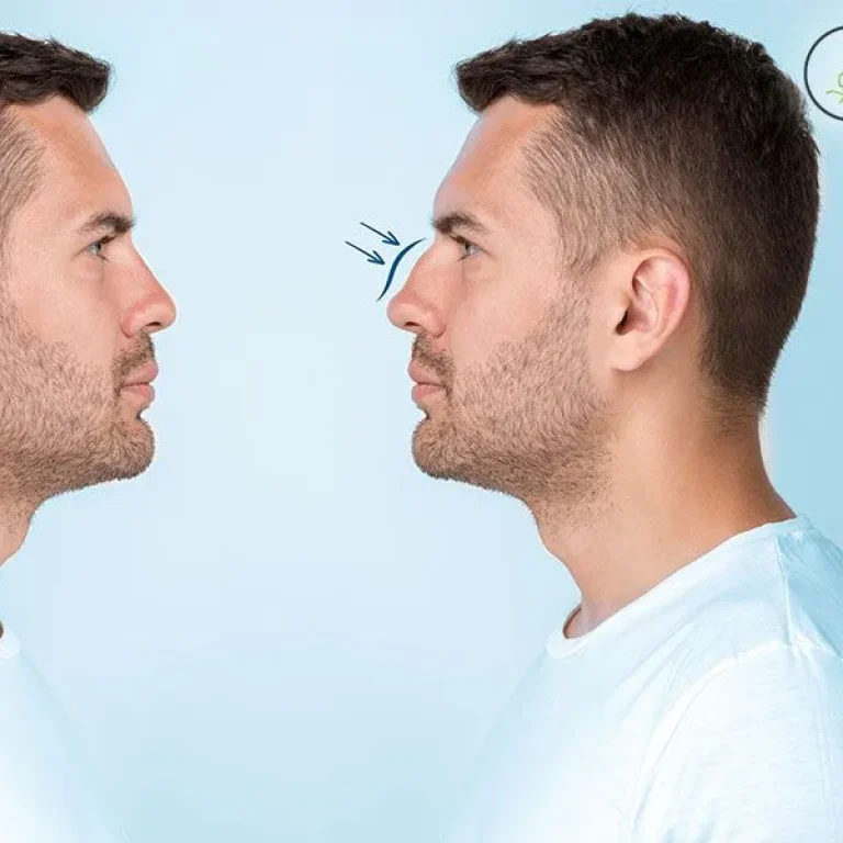 CIBlog-06-09-22q-1920w