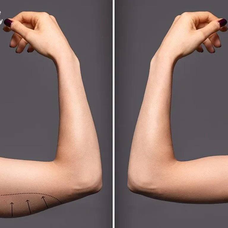 CIBlog-10-10-22w-1920w