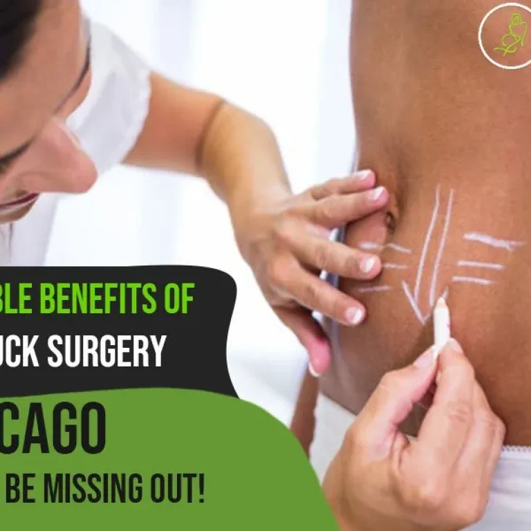 CIBlog-6+Incredible+Benefits+of+Tummy+Tuck+Surgery+in+Chicago+You+Could+Be+Missing+Out-1920w