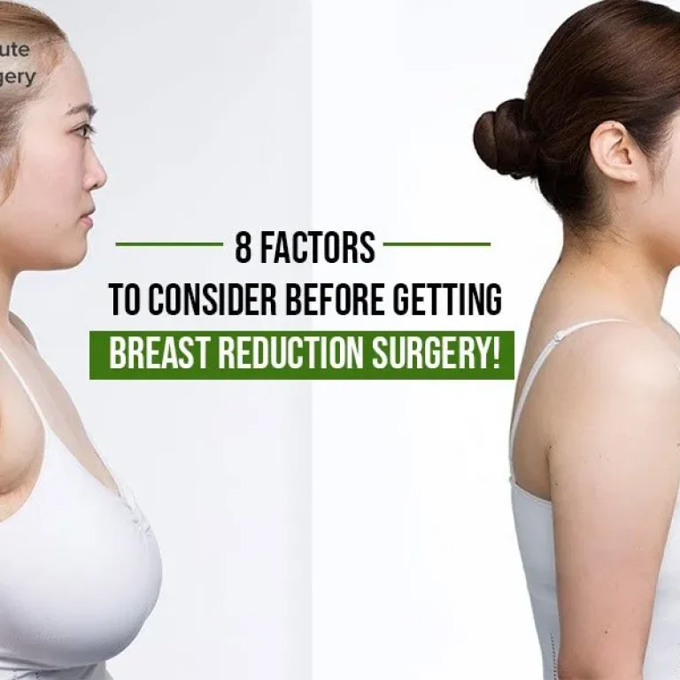 CIBlog-8+Factors+to+Consider+Before+Getting+Breast+Reduction+Surgery!-1920w