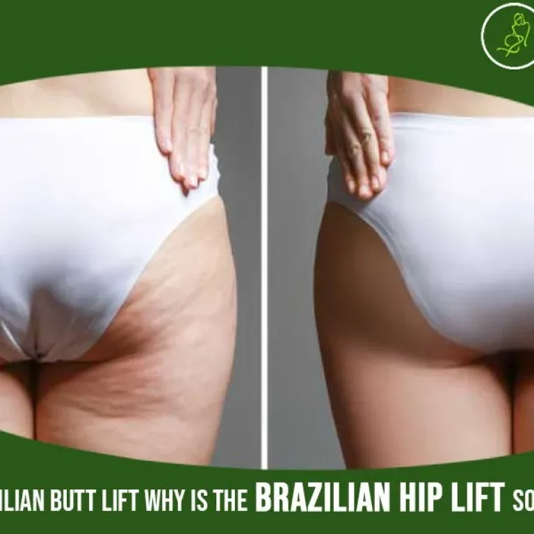 CIBlog-All+About+Brazilian+Butt+Lift-Why+is+the+Brazilian+hip+lift+so+popular+in+US-1920w