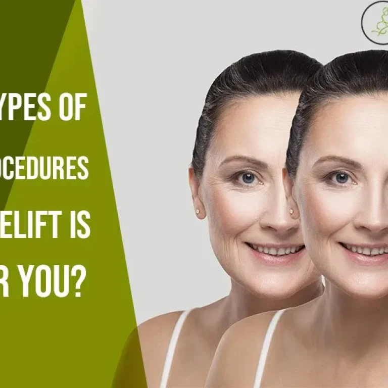 CIBlog-Various+Types+of+Facelift+Procedures-Which+Facelift+is+Right+for+You-1920w