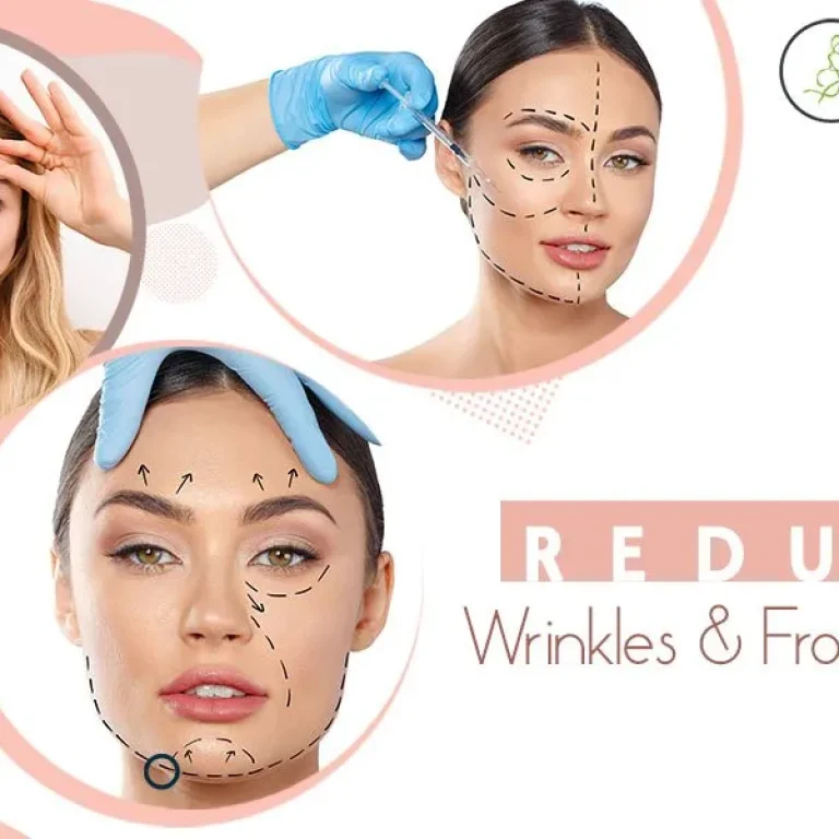 CI+Plastic+Surgery-Dysport+Treatment+–Reduce+Wrinkles+and+Frown+Lines-1920w