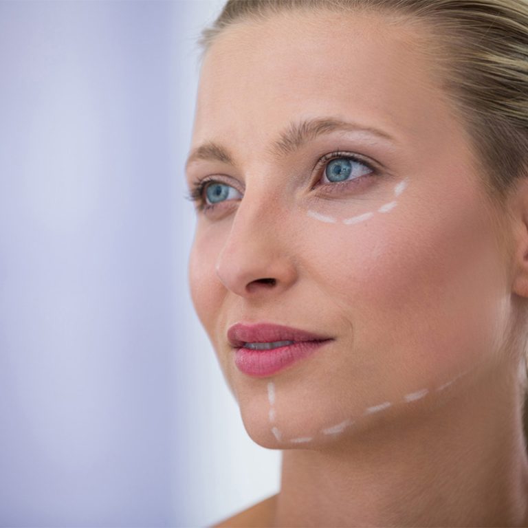 Can Combining a Facelift with Other Procedures Give You Better, Longer-Lasting Results_