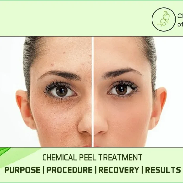 Chemical+Peel+Treatment+Purpose_Procedure_Recovery_Results,_Types+and+Benefits-1920w