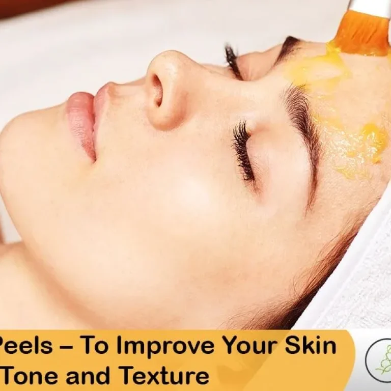 Chemical+Peels+Treatment–+Improve+Your+Skin+Tone+and+Texture-1920w