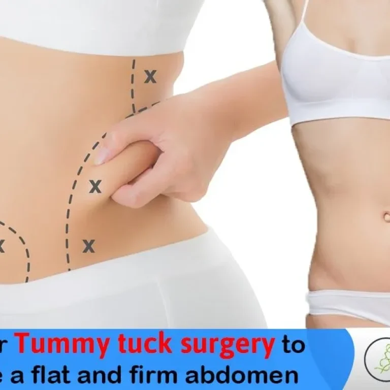 Consider+Tummy+tuck+surgery+-+Chicago+Institute+of+Plastic+Surgery-1920w