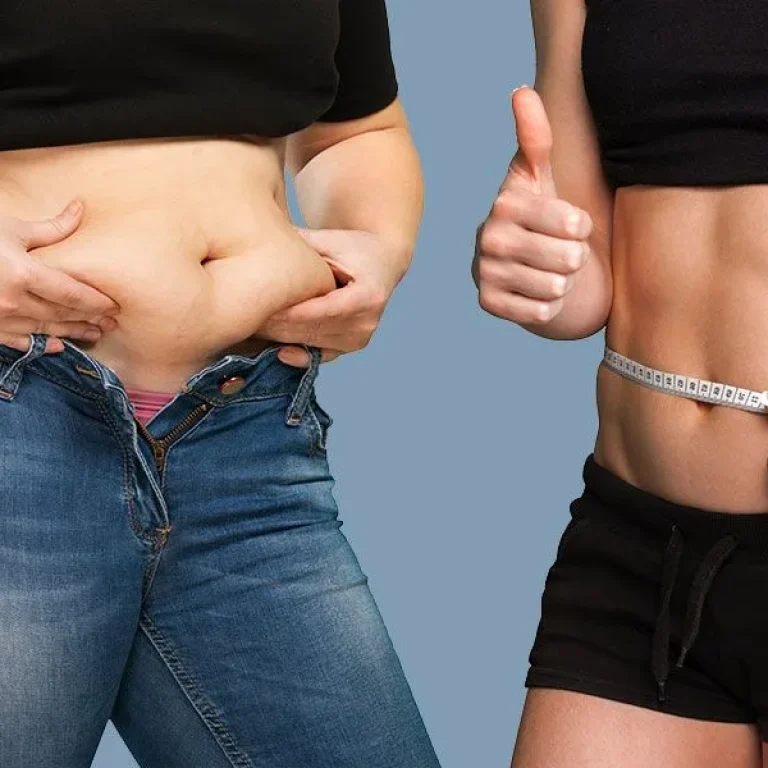 Destination+for+Liposuction+Surgery+and+Advanced+Body+Treatments+in+Chicago-1920w