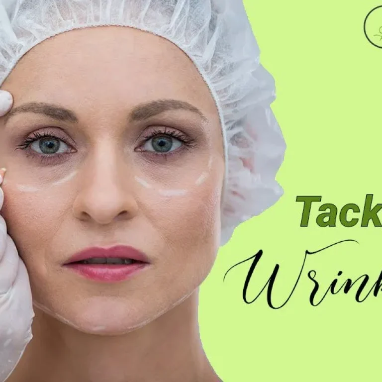 Different+Wrinkle+Smoothing+Treatments+to+Tackle+Age+Wrinkles-1920w
