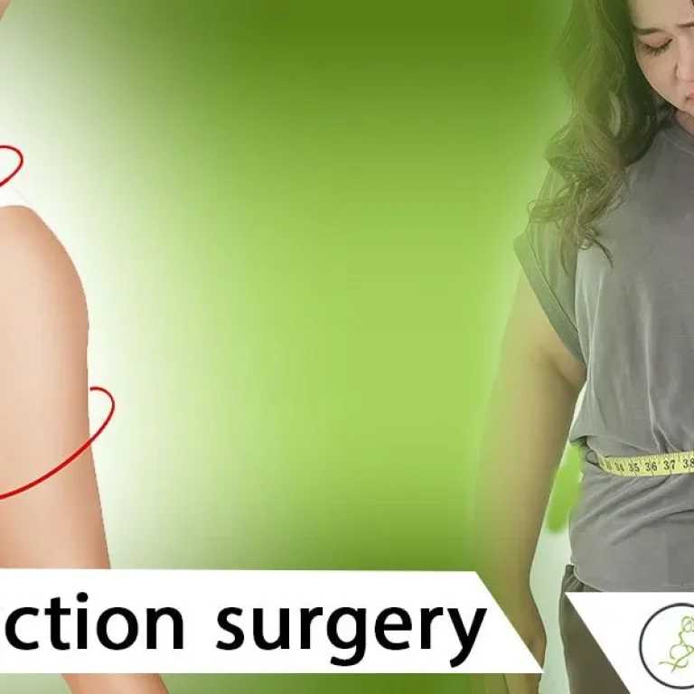 Enhance+your+body+shape+and+self-esteem+by+considering+Liposuction+surgery-1920w