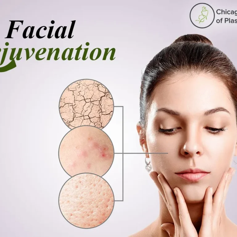 Facial+Rejuvenation+with+Juvederm-Know+How+Juvederm+Works+Wonders+for+your+Face!-1920w