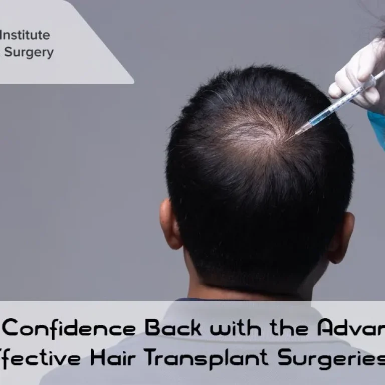 Get+Your+Confidence+Back+with+the+Advanced+and+Effective+Hair+Transplant+Surgeries-1920w