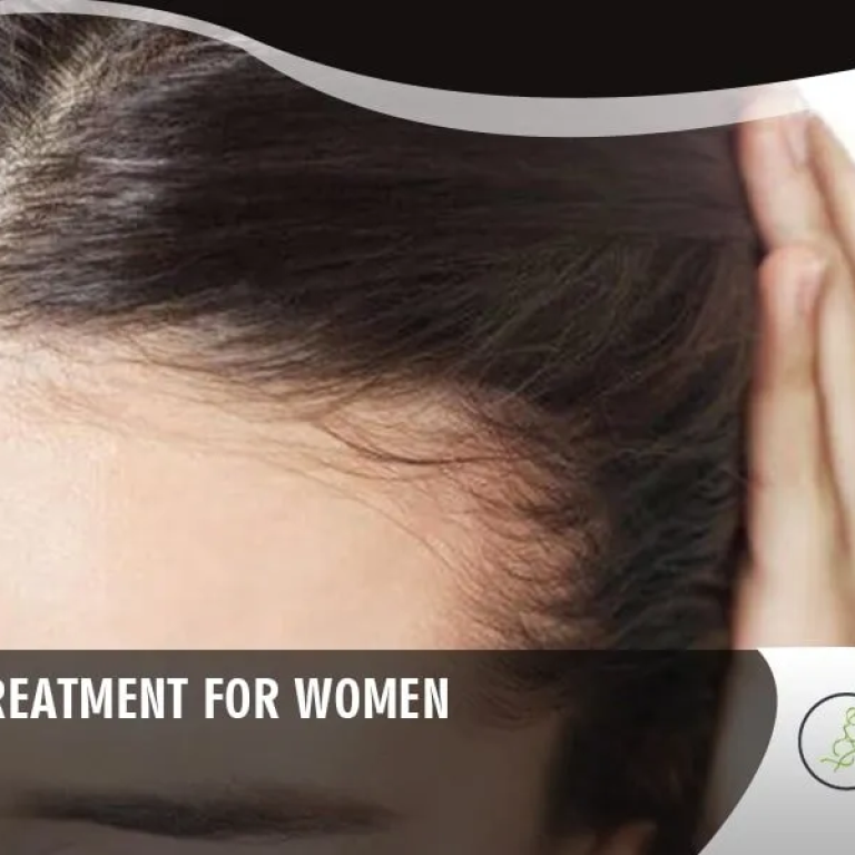 Hair+loss+treatment+for+Women+in+Chicago-1920w