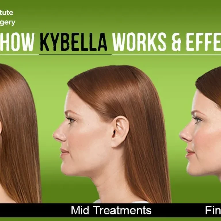 How+Kybella+works+and+why+it+is+so+effective-1920w
