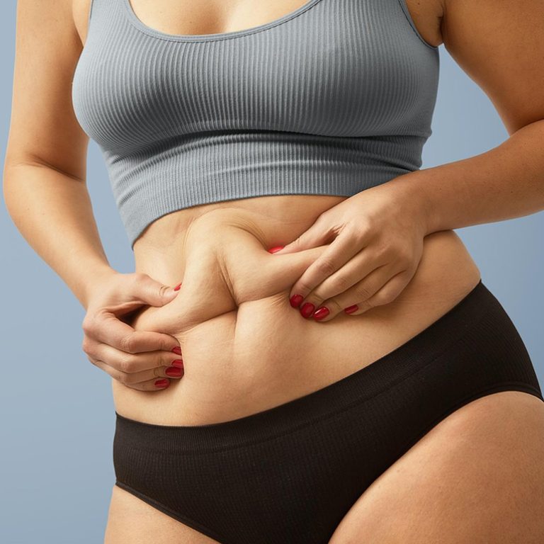 Is Liposuction a Solution for Losing Weight or Reshaping Your Body_