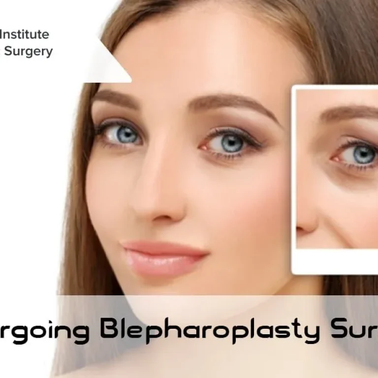 Is+Eyelid+SurgeryBlepharoplasty+Procedure+Right+For+You-1920w