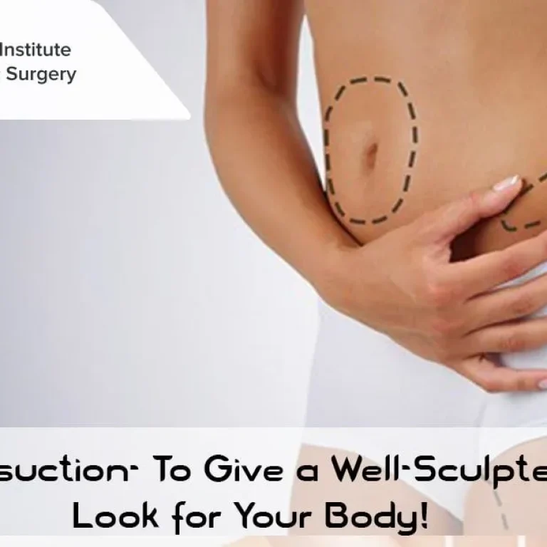 Liposuction-+To+Give+a+Well-Sculpted+Look+for+Your+Body!-min-1920w
