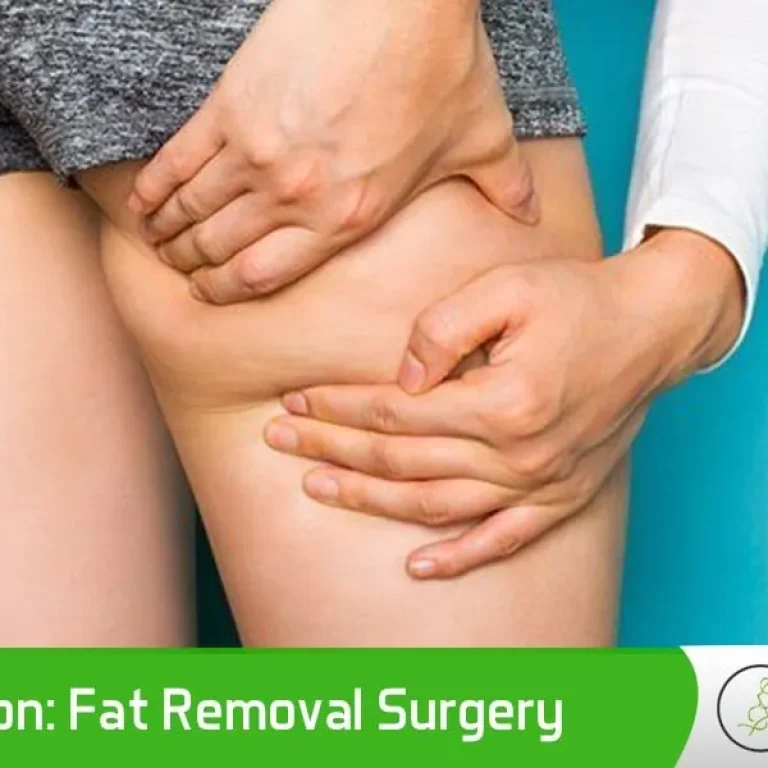 Liposuction+Fat+Removal+Surgery-CI+Plastic+Chicago-1920w