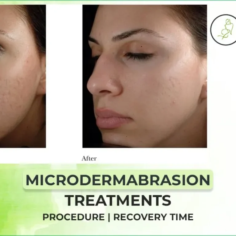 Microdermabrasion+Treatments+Procedure++Cost++Recovery+Time+Uses+and+Benefits_1024x600-1920w