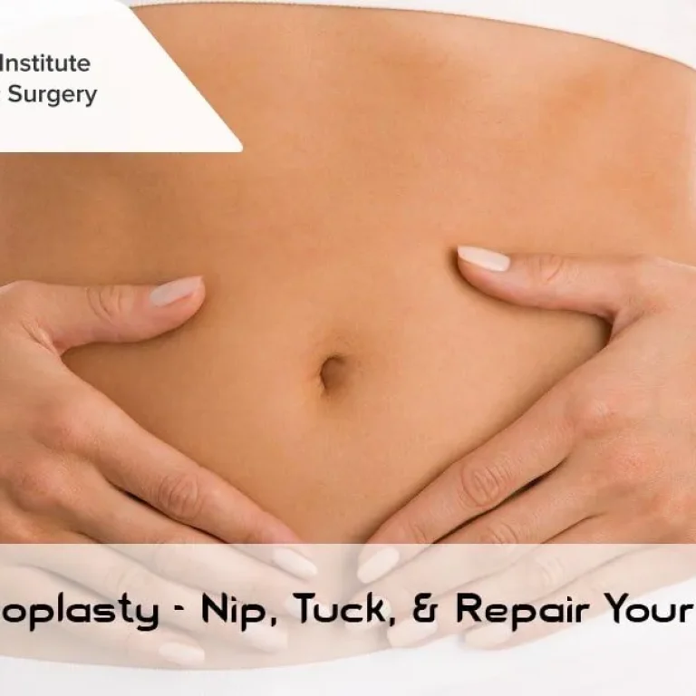 Nip,+Tuck+and+Repair+Your+Tummy+with+Abdominoplasty!-1920w