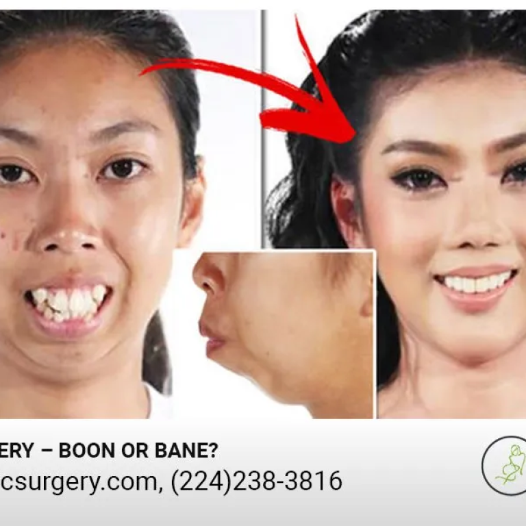 Plastic Surgery – Boon or Bane