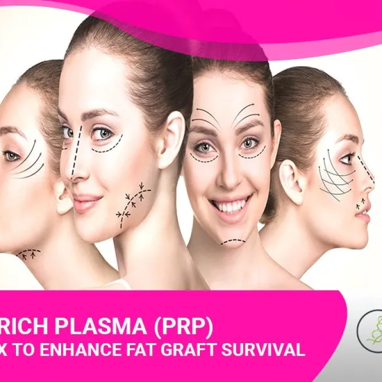 Platelet Rich Plasma (PRP)