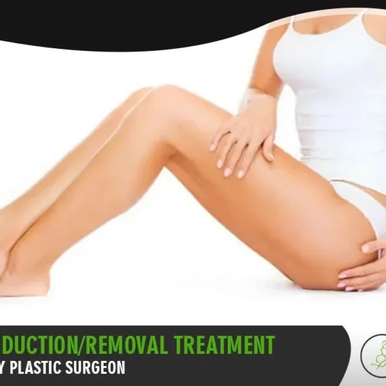 Removal+Treatment+Recommended+By+Plastic+Surgeon-1920w