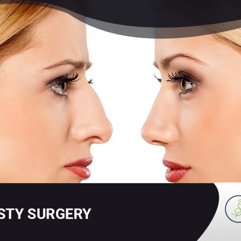 Rhinoplasty+surgery-1920w