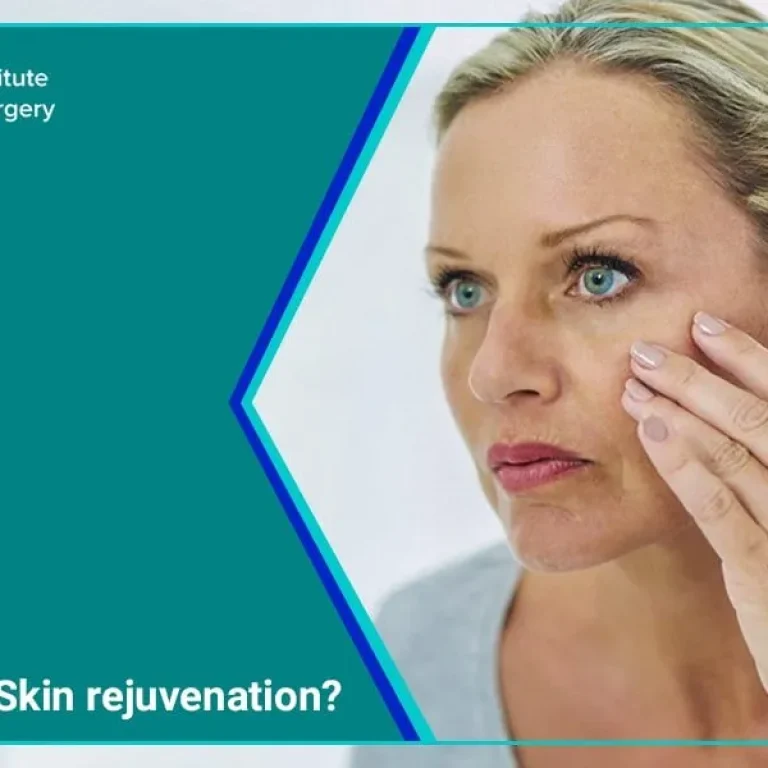 Sculptra+Skin+post+(1)-min-1920w