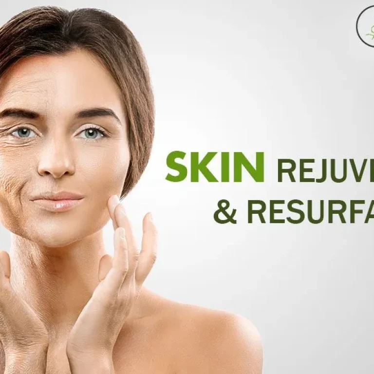 Skin+Rejuvenation+And+Resurfacing+Treatment+in+Chicago-1920w