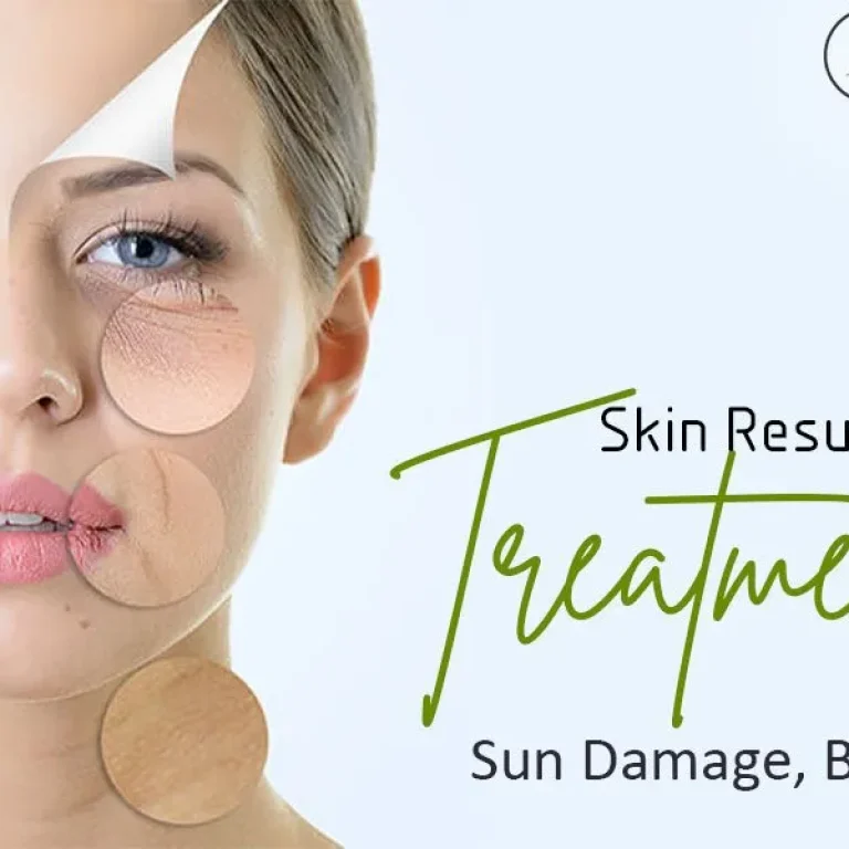 Skin+Resurfacing+Treatments+-+Minimize+blemishes,+treat+sun+damage+&+restore+a+more+youthful-1920w