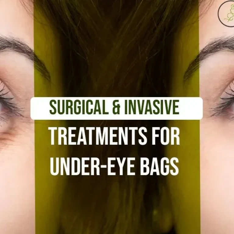 Surgical+and+Invasive+Treatments+for+Under-eye+Bags-1920w