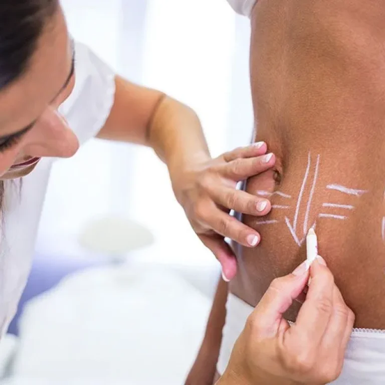 What+Factors+Contribute+to+the+Popularity+of+Mommy+Makeovers-Blog+(1)-1920w