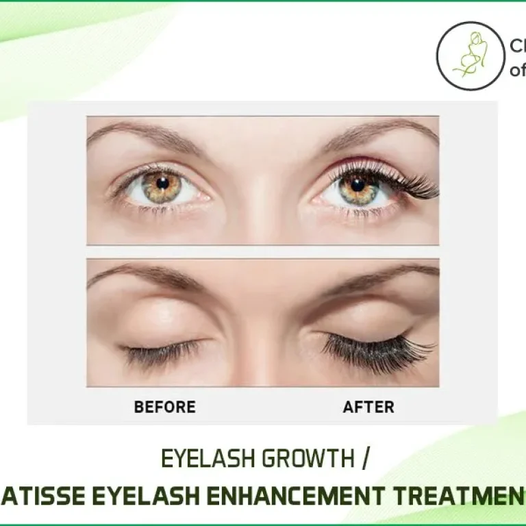 What+Is+Eyelash+Growth+Or+Latisse+Eyelash+Enhancement+Treatment+How+It+Is+Safe+For+Your+Eyes-1920w