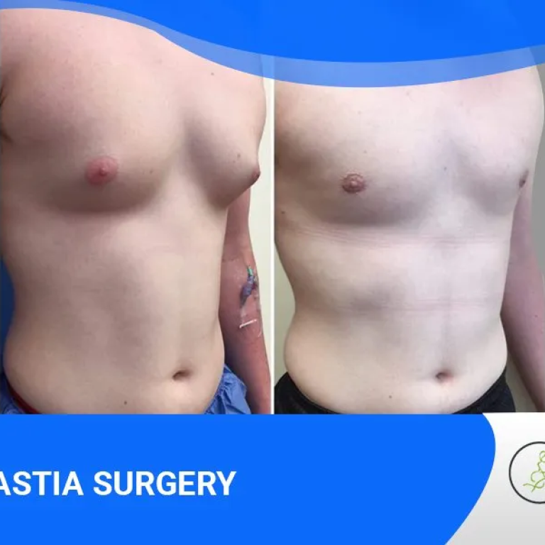 Scalp PRP hair restoration with improved density, Chicago