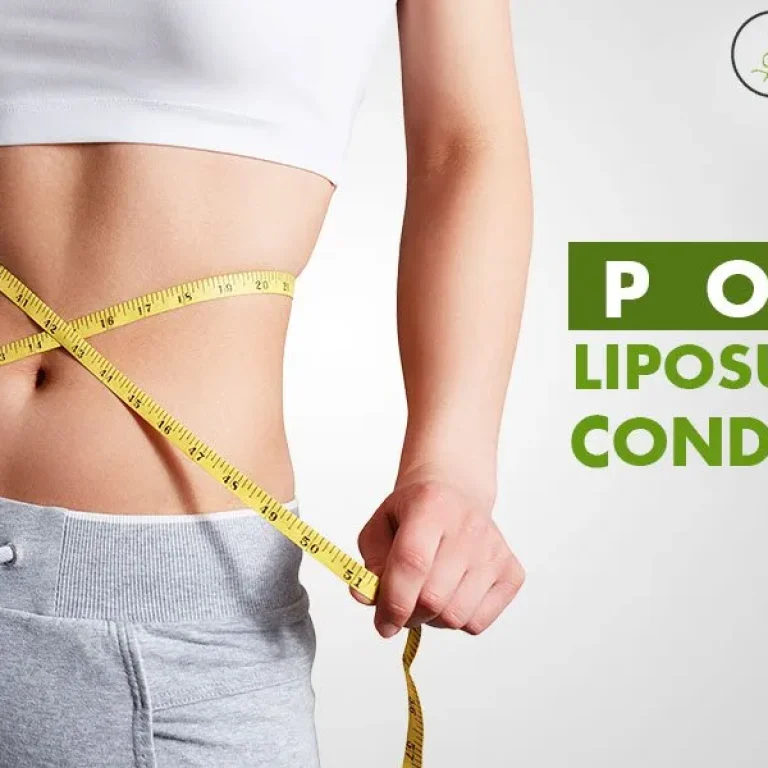 What+is+Liposuction+and+What+Are+Post+Liposuction+Conditions-1920w