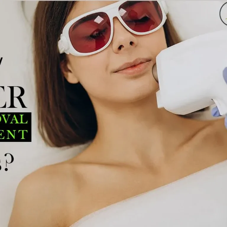 What+is+laser+hair+removal_+And+how+laser+hair+removal+treatment+works_-1920w