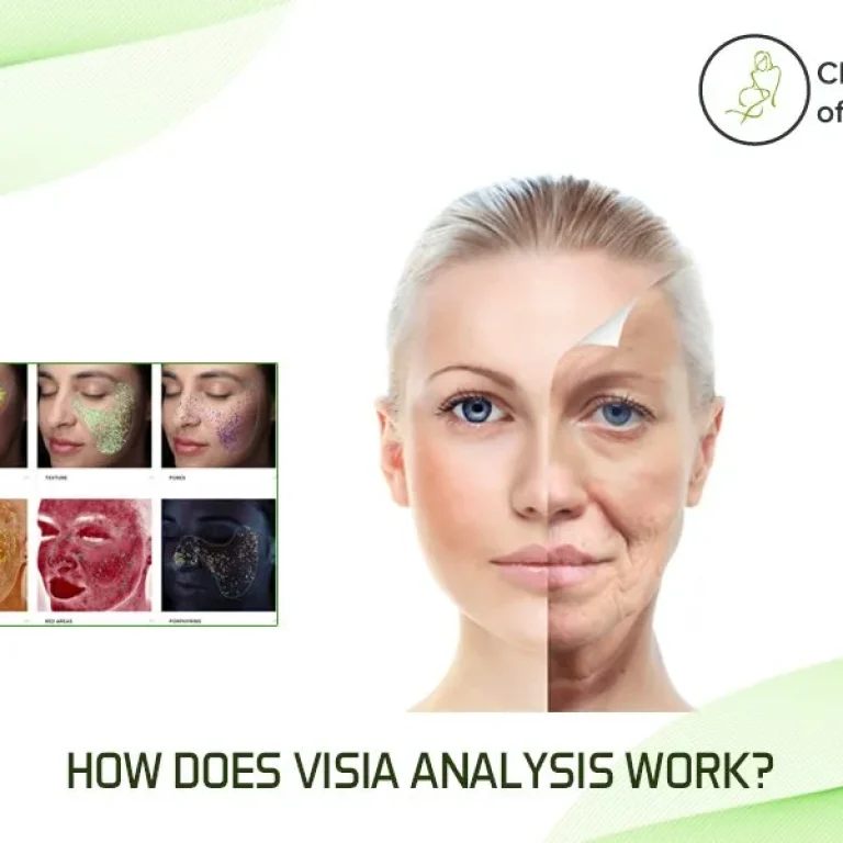 What+is+the+VISIA+Skin+Analysis-How+Does+Visia+Analysis+Work-Key+Benefits-1920w