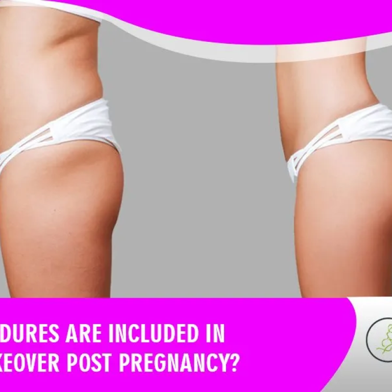 What+procedures+are+included+in+Mommy+Makeover+Post+Pregnancy+(1)-1920w