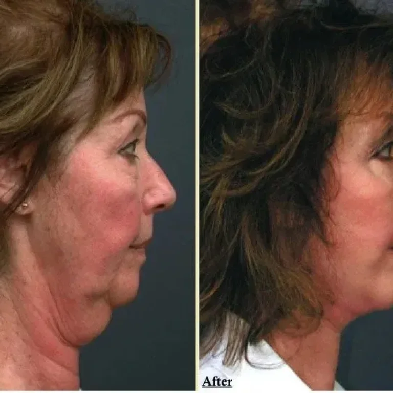 face18-1920w+(1)-1920w