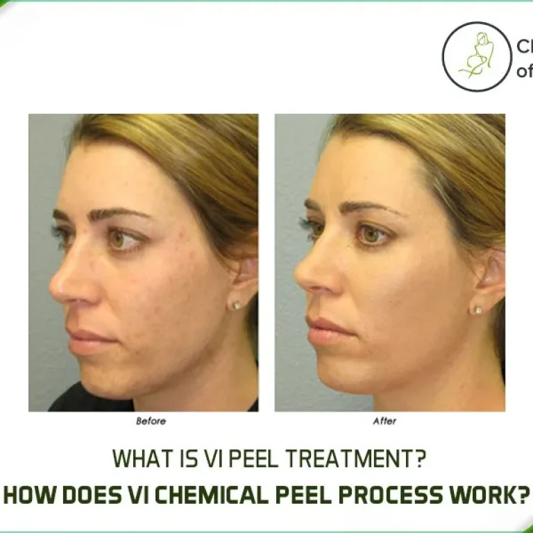 plastic+surgery+vipeel+treatment_chicago_institute_of_plastic_surgery-1920w